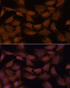 Immunofluorescence analysis of C6 cells using Anti-NCAPD2 Antibody (A305867) at a dilution of 1:100. DAPI was used to stain the cell nuclei (blue)