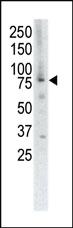 Anti-MUSK Rabbit Polyclonal Antibody