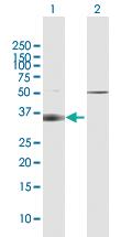 Anti-SLC14A1 Rabbit Polyclonal Antibody