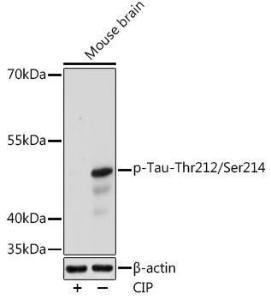 Western blot analysis of extracts of Mouse brain, using Anti-Tau (phospho Thrhr212 + Ser214) Antibody (A308571) at 1:1,000 dilution