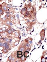 Anti-MUSK Rabbit Polyclonal Antibody