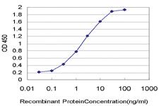 Anti-FABP4 Mouse Monoclonal Antibody [clone: 2H3-1G10]