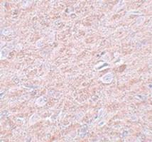 Anti-PRDM16 Rabbit Polyclonal Antibody