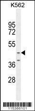 Anti-OC90 Rabbit Polyclonal Antibody (FITC (Fluorescein Isothiocyanate))