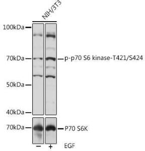 Western blot analysis of extracts of NIH/3T3 cells, using Anti-S6K1 (phospho Thr421 + Ser424) Antibody (A308572) at 1:1,000 dilution or P70 S6K antibody (A16968)