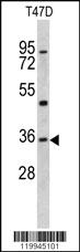 Anti-KLF6 Rabbit Polyclonal Antibody