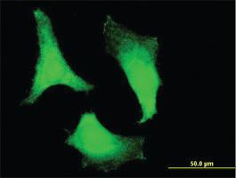 Anti-RPS2 Mouse Monoclonal Antibody [clone: 3G6]