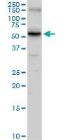 Anti-SLC14A1 Rabbit Polyclonal Antibody