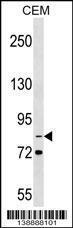 Anti-ITGB2 Rabbit Polyclonal Antibody (AP (Alkaline Phosphatase))