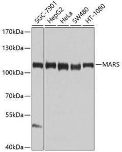 Anti-MetRS/MARS Antibody (A10846)