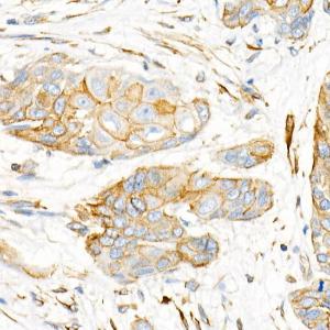 Anti-Plectin Rabbit Monoclonal Antibody [clone: ARC2270]