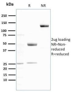 SDS-PAGE analysis of Anti-Ubiquitin Antibody [UBB/3143R] under non-reduced and reduced conditions; showing intact IgG and intact heavy and light chains, respectively. SDS-PAGE analysis confirms the integrity and purity of the antibody.