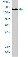 Anti-ZFYVE20 Goat Polyclonal Antibody