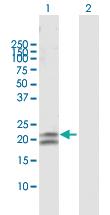 Anti-CEACAM21 Rabbit Polyclonal Antibody