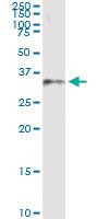 Anti-DHDH Polyclonal Antibody Pair