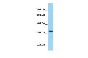 Anti-RHD Rabbit Polyclonal Antibody