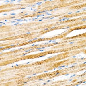 Anti-Plectin Rabbit Monoclonal Antibody [clone: ARC2270]