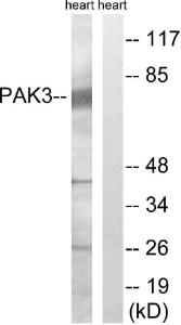 Western blot analysis of lysates from rat heart cells using Anti-PAK3 Antibody. The right hand lane represents a negative control, where the antibody is blocked by the immunising peptide