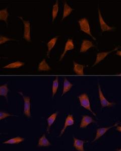 Immunofluorescence analysis of L929 cells using Anti-NCAPD2 Antibody (A305867) at a dilution of 1:100. DAPI was used to stain the cell nuclei (blue)