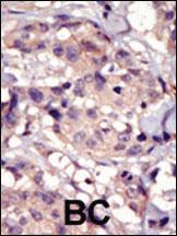 Anti-PDGFRA Rabbit Polyclonal Antibody