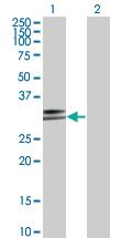 Anti-HLA-DPA1 Mouse Monoclonal Antibody [clone: 1E3]