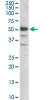 Anti-SMARCE1 Goat Polyclonal Antibody