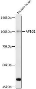 Western blot analysis of extracts of various cell lines, using Anti-gamma Adaptin Antibody (A307586) at 1:1000 dilution