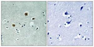 Immunohistochemical analysis of paraffin-embedded human brain using Anti-PAK3 Antibody 1:100 (4 °C overnight). The right hand panel represents a negative control, where the antibody was pre-incubated with the immunising peptide