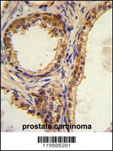 Anti-CREB3L1 Rabbit Polyclonal Antibody