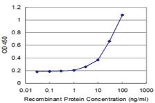 Anti-HLA-DPA1 Mouse Monoclonal Antibody [clone: 1E3]