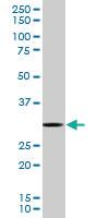 Anti-RPS3 Mouse Monoclonal Antibody [clone: 2A8]