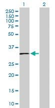 Anti-SLC14A1 Rabbit Polyclonal Antibody