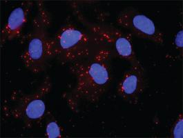 Anti-AKT1 + HSPB1 Antibody Pair