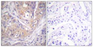 Antibody anti-LCK phospho TYR505 100 µg