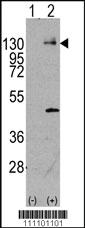 Anti-PDGFRA Rabbit Polyclonal Antibody