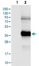 Anti-MLC1 Rabbit Polyclonal Antibody