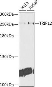 Western blot analysis of extracts of various cell lines, using Anti-TRIP12 / ULF Antibody (A10849) at 1:1,000 dilution. The secondary antibody was Goat Anti-Rabbit IgG H&L Antibody (HRP) at 1:10,000 dilution.