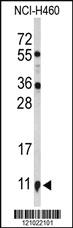 Anti-KLK10 Rabbit Polyclonal Antibody