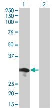 Anti-RABL2B Mouse Monoclonal Antibody [clone: 1B10]