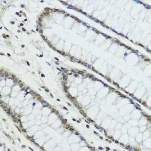 Immunohistochemistry analysis of paraffin-embedded human colon tissue using Anti-TRIP12 / ULF Antibody (A10849) at a dilution of 1:100 (40x lens). Perform microwave antigen retrieval with 10 mM PBS buffer pH 7.2 before commencing with IHC staining protocol.