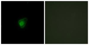 Immunofluorescence analysis of HepG2 cells using Anti-SMG7 Antibody. The right hand panel represents a negative control, where the antibody was pre-incubated with the immunising peptide.