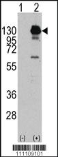 Anti-PDGFRA Rabbit Polyclonal Antibody