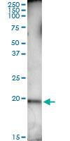 Anti-STK32A Polyclonal Antibody Pair