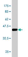 Anti-FABP1 Mouse Monoclonal Antibody [clone: 5F7]