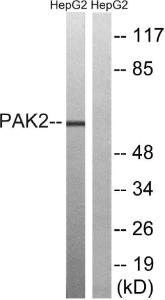 Western blot analysis of lysates from HepG2 cells, treated with serum 20% 15' using Anti-PAK2 Antibody. The right hand lane represents a negative control, where the antibody is blocked by the immunising peptide.