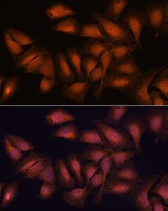 Immunofluorescence analysis of U2OS cells using Anti-NCAPD2 Antibody (A305867) at a dilution of 1:100. DAPI was used to stain the cell nuclei (blue)