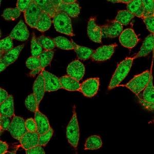 Immunofluorescent analysis of PFA fixed HeLa cells stained with Anti-UBE2B Antibody [PCRP-UBE2B-1C7] followed by Goat Anti-Mouse IgG (CF&#174; 488) (Green). Counterstain is Phalloidin.