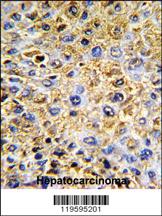 Anti-DCN Rabbit Polyclonal Antibody