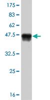 Anti-LEF1 Mouse Monoclonal Antibody [clone: 2E2]