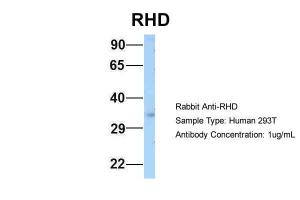 Anti-RHD Rabbit Polyclonal Antibody